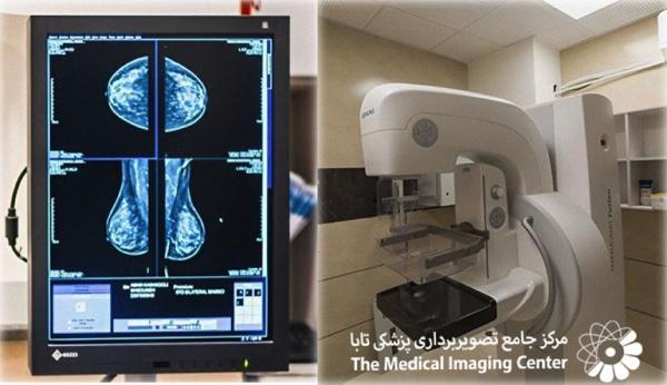 ماموگرافی تابا؛ آیا برترین مرکز رادیولوژی در ایران را می شناسید؟